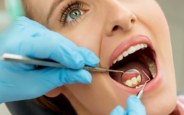 limpieza dental clinica alcala de henares
